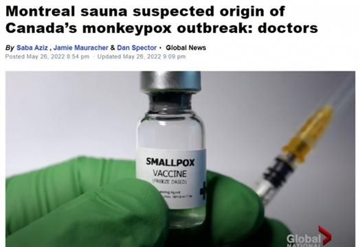加拿大第一起猴痘病例疑在桑拿浴室感染